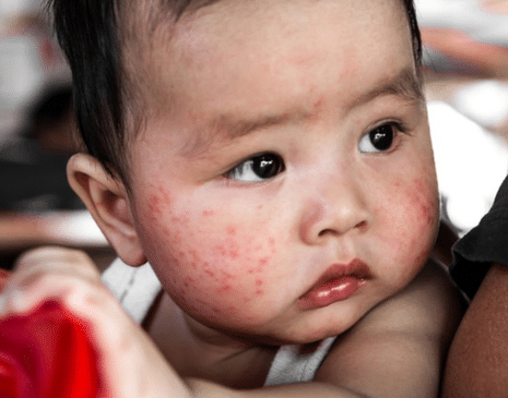 Best Cleaning Products for Asthma and Allergies